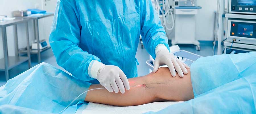 laser endovenoso para tratamento de varizes
