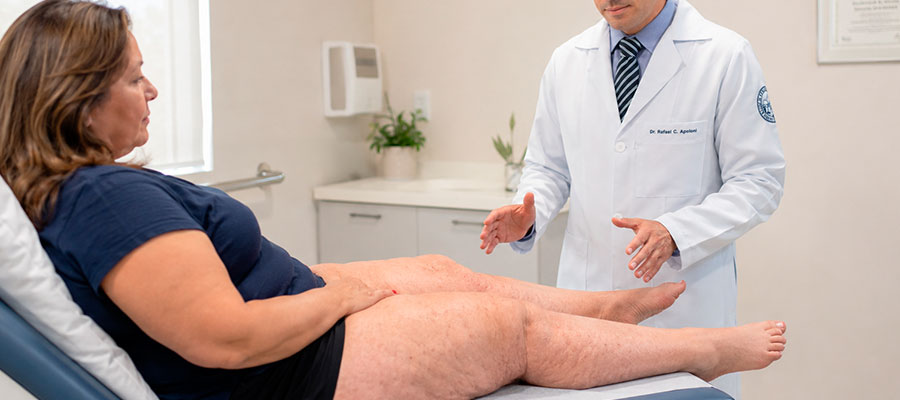 Cirurgia do Lipedema: técnicas e tempo de recuperação